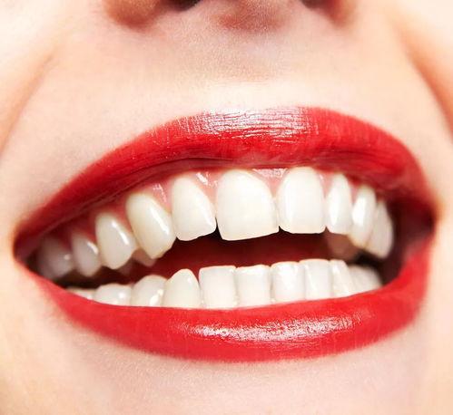 成人牙掉了搞笑视频下载,搞笑视频带你重温掉牙瞬间